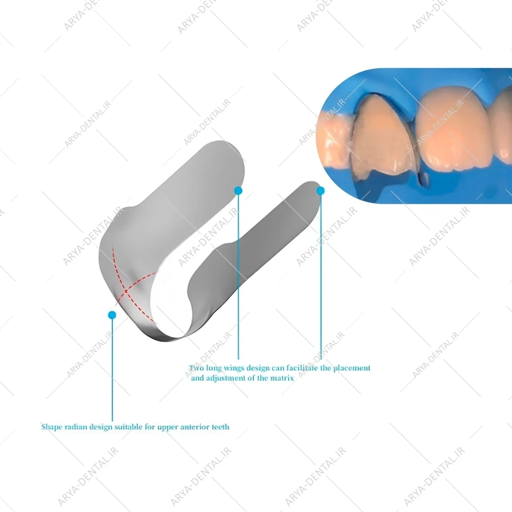 نوار ماتریس ونیر Zt Dental